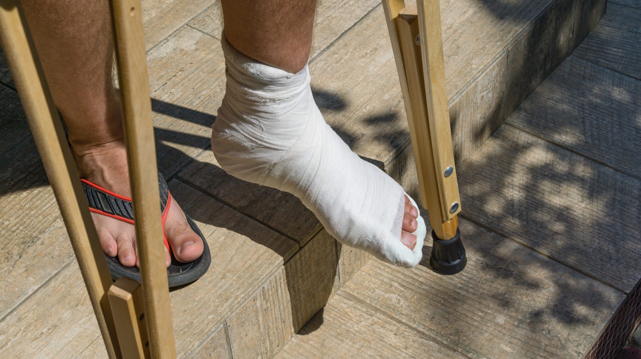 Break my leg hurt me bad. Сломала ногу гипс костыли. Человек на костылях. Костыли при переломе пальца ноги.